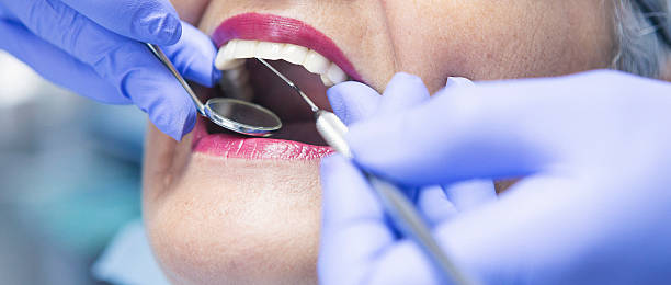 Best Emergency Tooth Extraction in Fort Bliss, TX